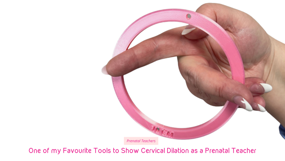 Cervical Dilation Rings: How you can use Them in Childbirth Education