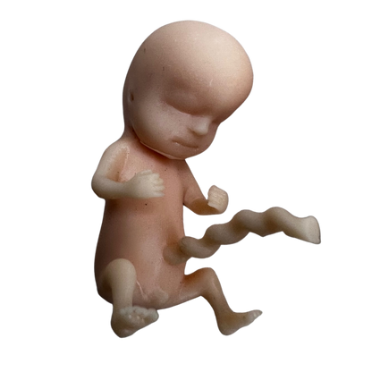 Image of 3D printed 12 week fetus model and the presence of fingers, toes, emerging sex organs, ear buds and umbilical cord.